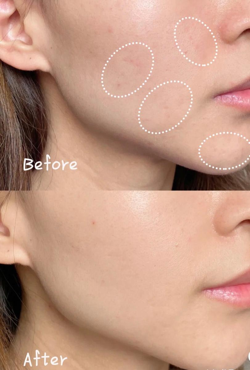 Review Thumbnail Image 1 195475241