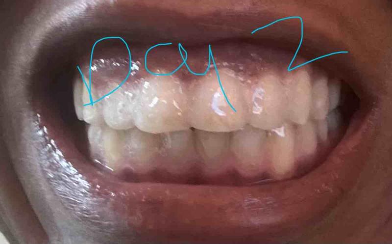 Review Thumbnail Image 1 243472213