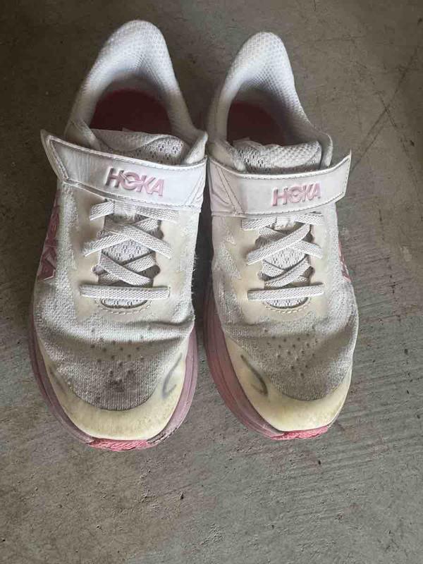 Customer photo for "Yellowing After Just a Few Months"