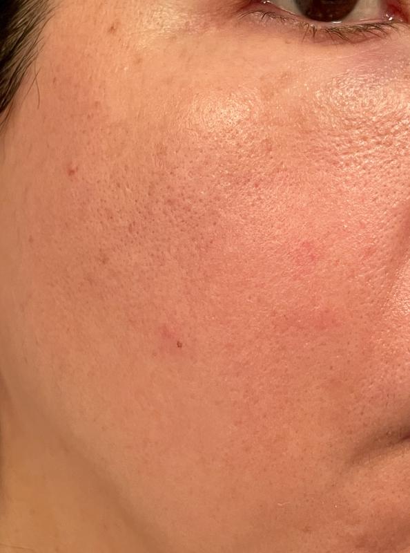Customer photo for "Glowy finish, but no major results after 30 days"