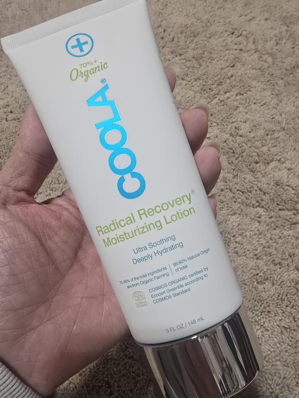 Customer photo for "Ultimate skin saver after sun"