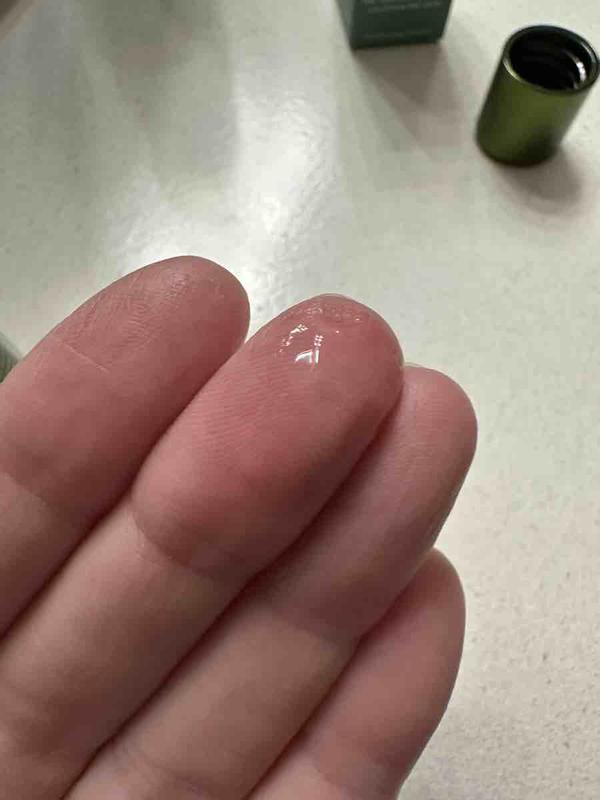 Customer photo for "My Skin Responded Very Well!!"