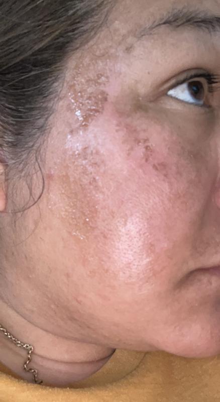 Review Thumbnail Image 0 242336494