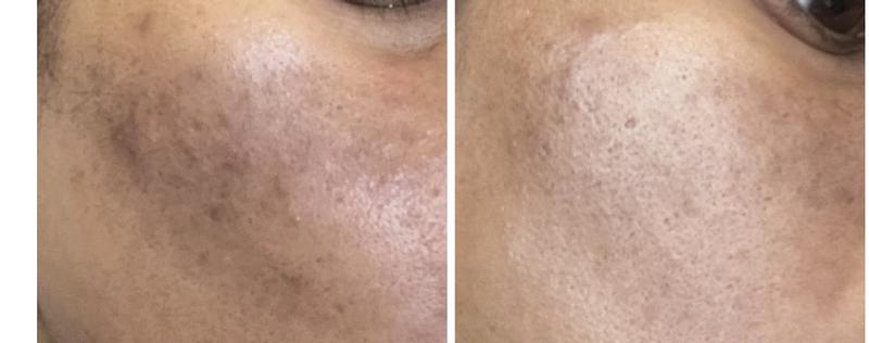 Review Thumbnail Image 0 248263580