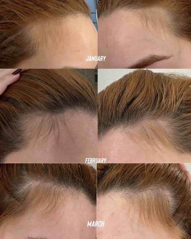 Review Thumbnail Image 0 232377719