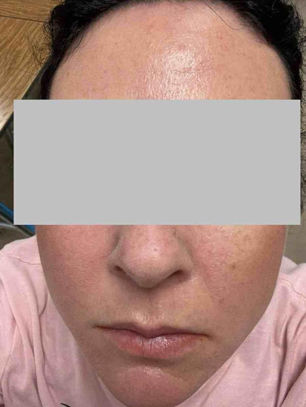 Review Thumbnail Image 0 244001151