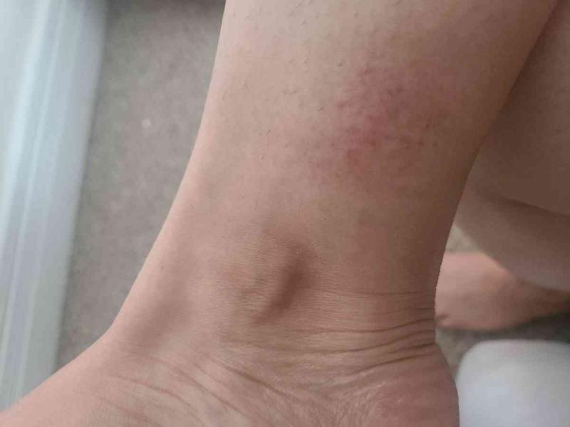 Cute but leaving a mark