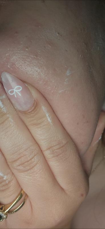 Customer photo for "Deep Moisturizer but.."