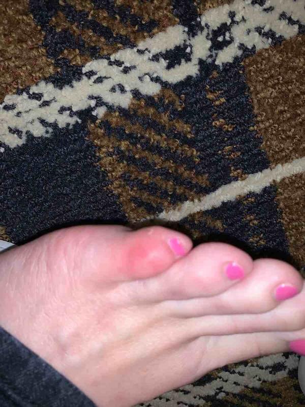 So cute and so blister-raising