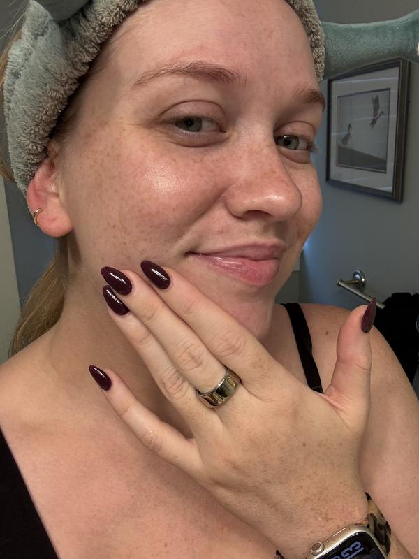Customer photo for "A dry skin miracle worker!"