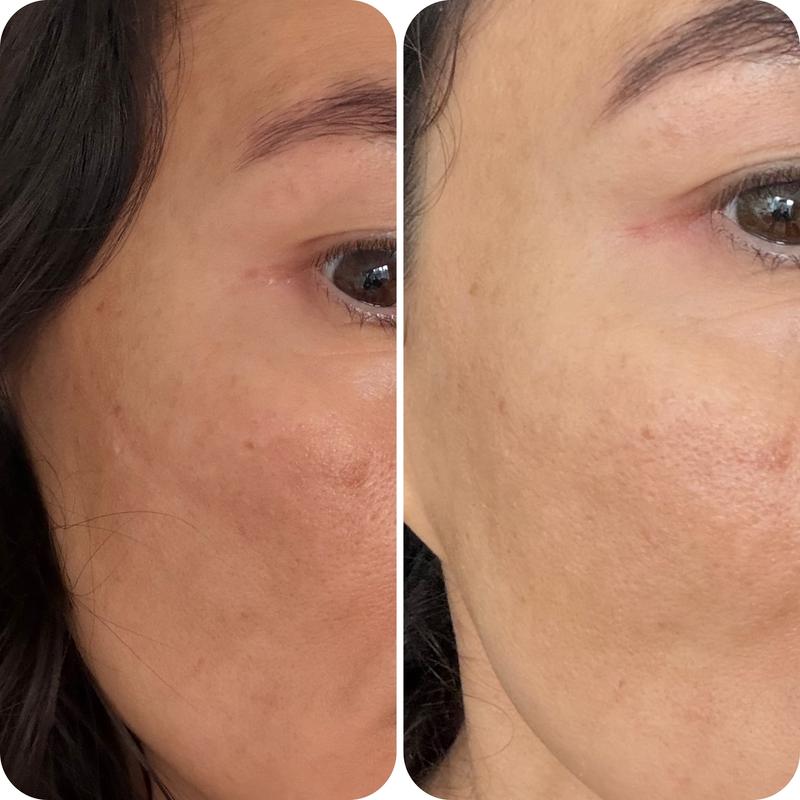 Review Thumbnail Image 0 249167346