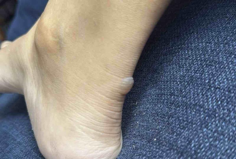 Customer photo for "Stylish but brutal on the feet"