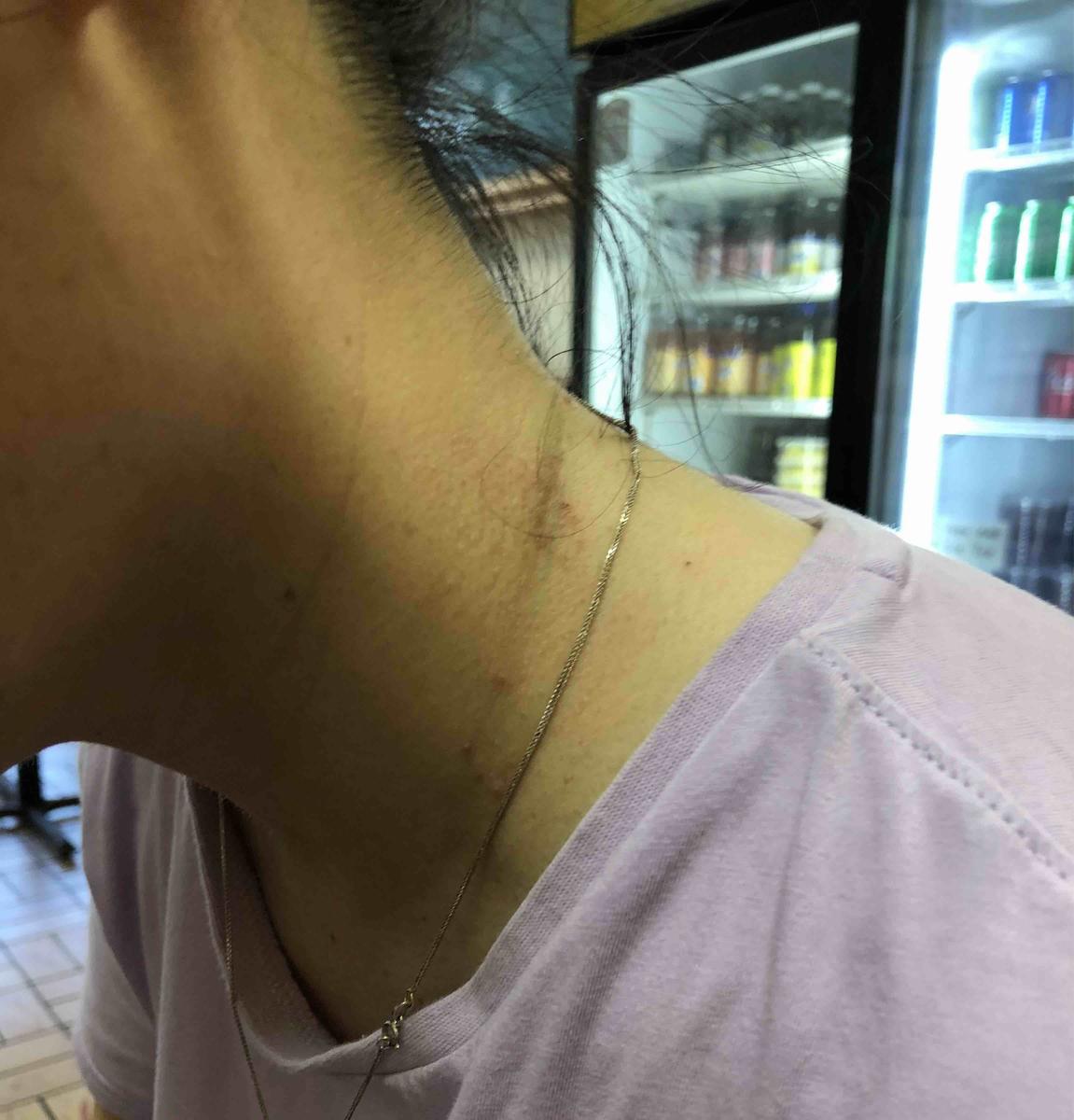 Review Thumbnail Image 0 209608185