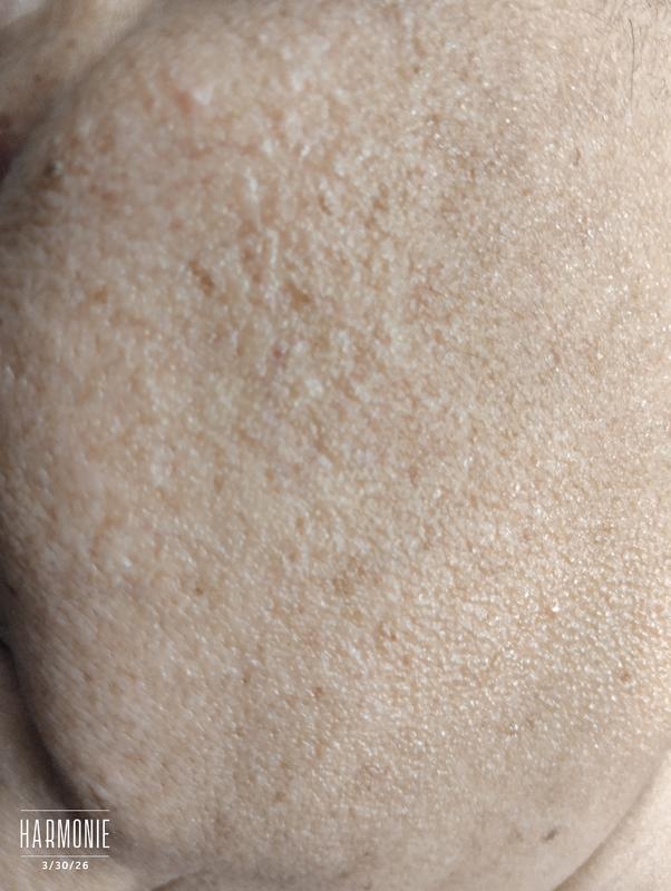 Review Thumbnail Image 0 249134319