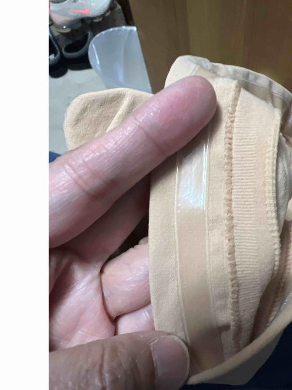 Customer photo for "Grip causes rash"