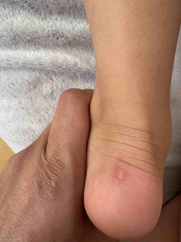 Customer photo for "Defect heel support!!"