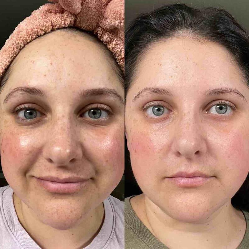 Review Thumbnail Image 0 221335366