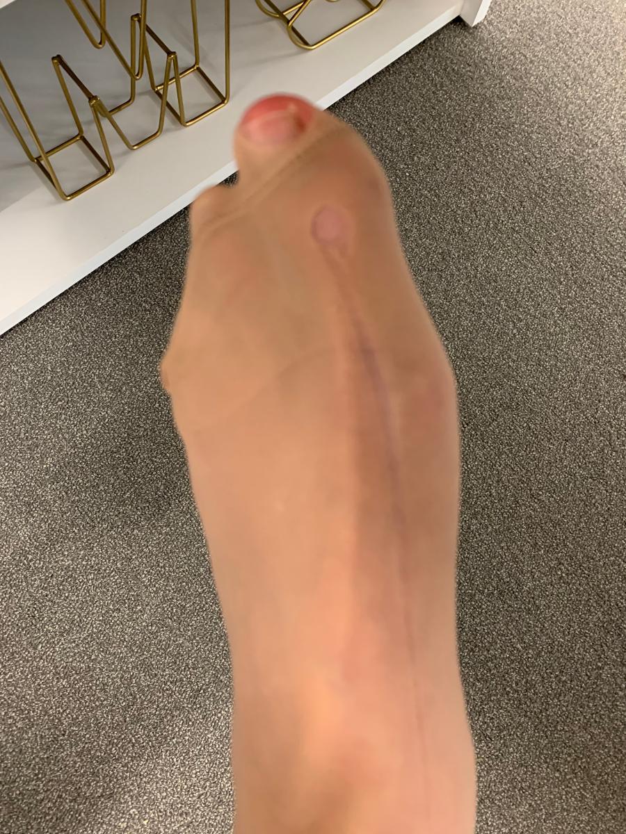 Review Thumbnail Image 0 191651076