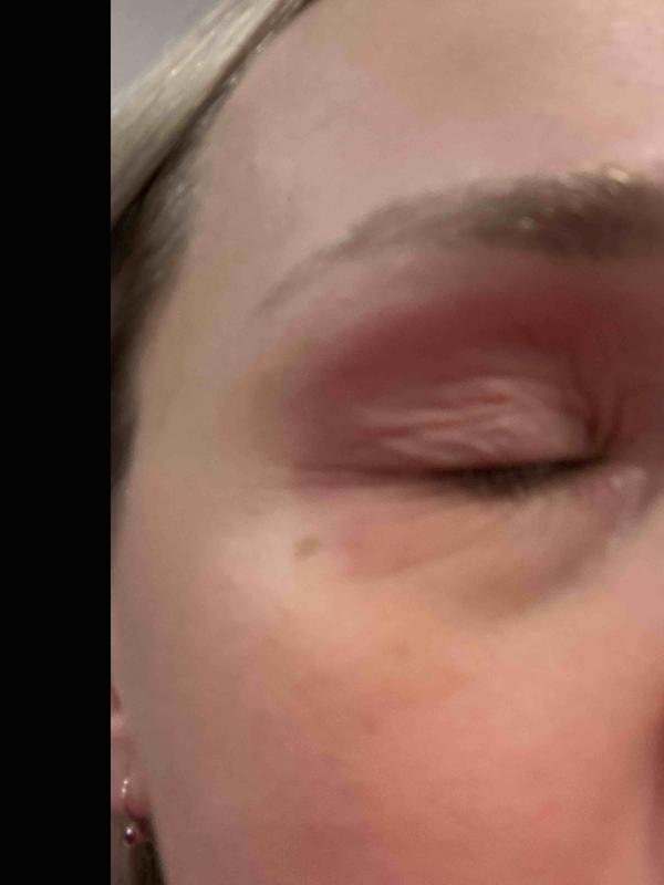 Review Thumbnail Image 0 248260675