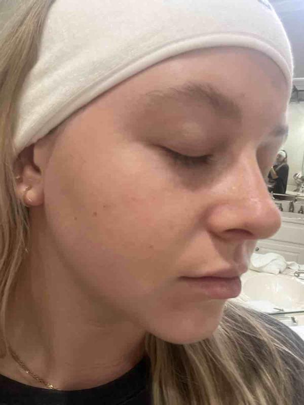 Review Thumbnail Image 0 221669979