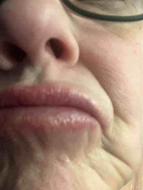 Review Thumbnail Image 1 247752608