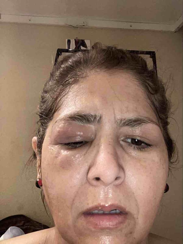 Customer photo for "Worst Experience"