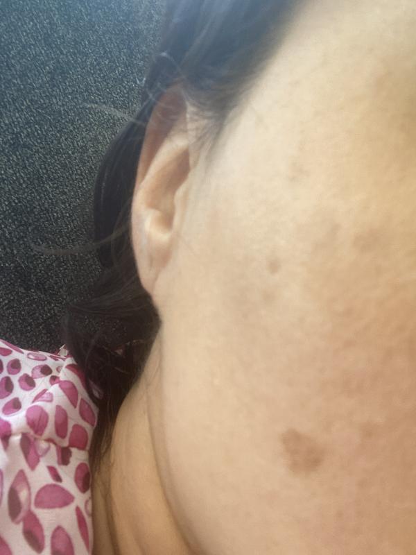 Customer photo for "I did not see changes on my face."