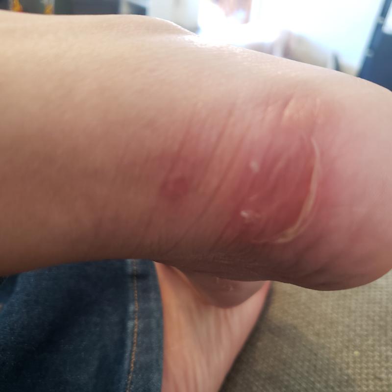 Customer photo for "Not worth the price"