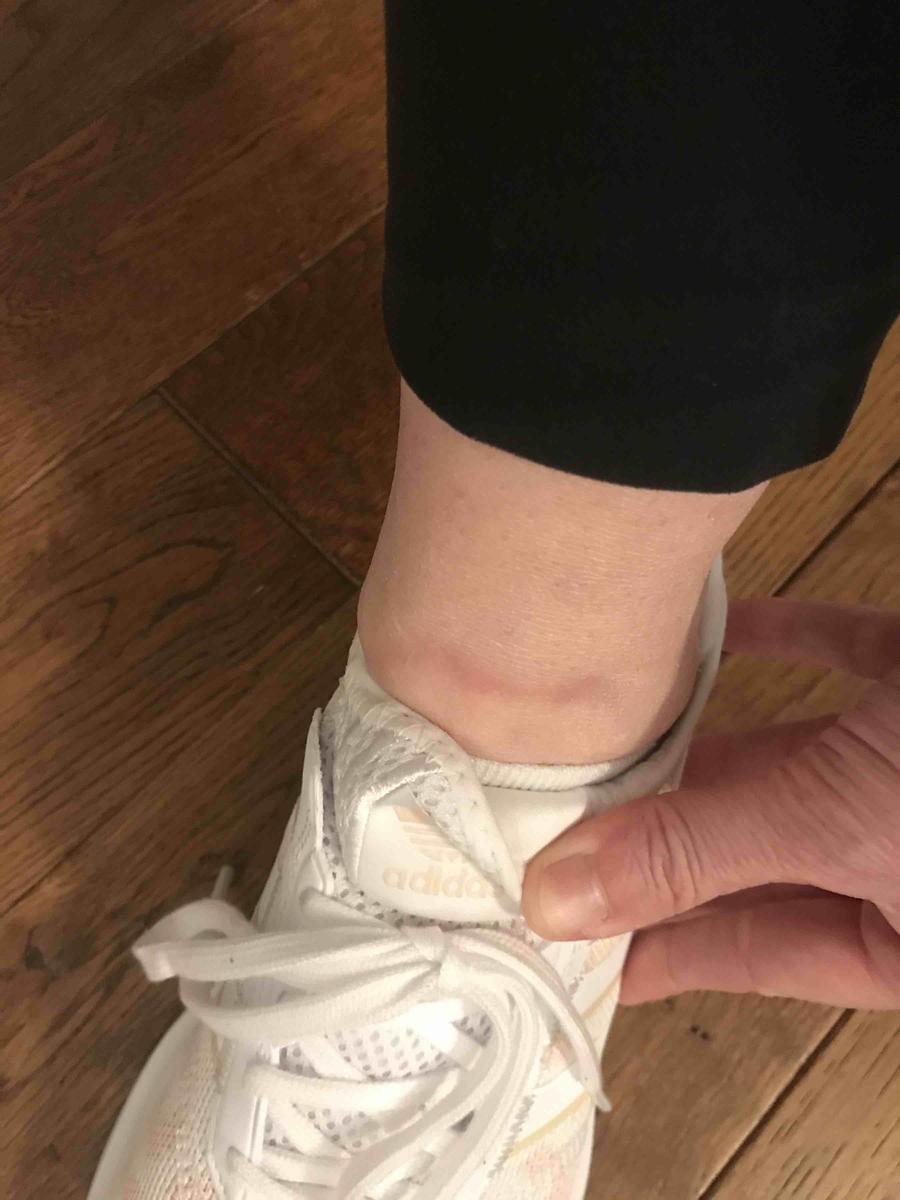 An awesome sneaker ruined with dumb design