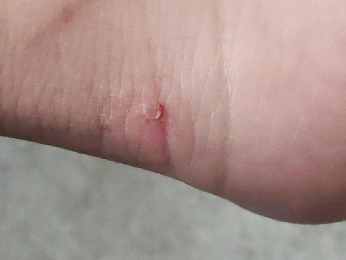 Review Thumbnail Image 0 209793292