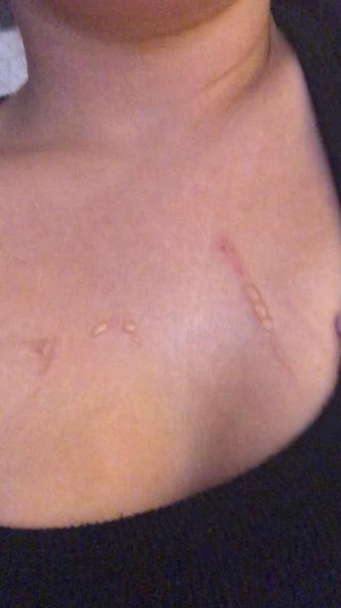 Customer photo for "This tape is toxic to skin and dangerous"