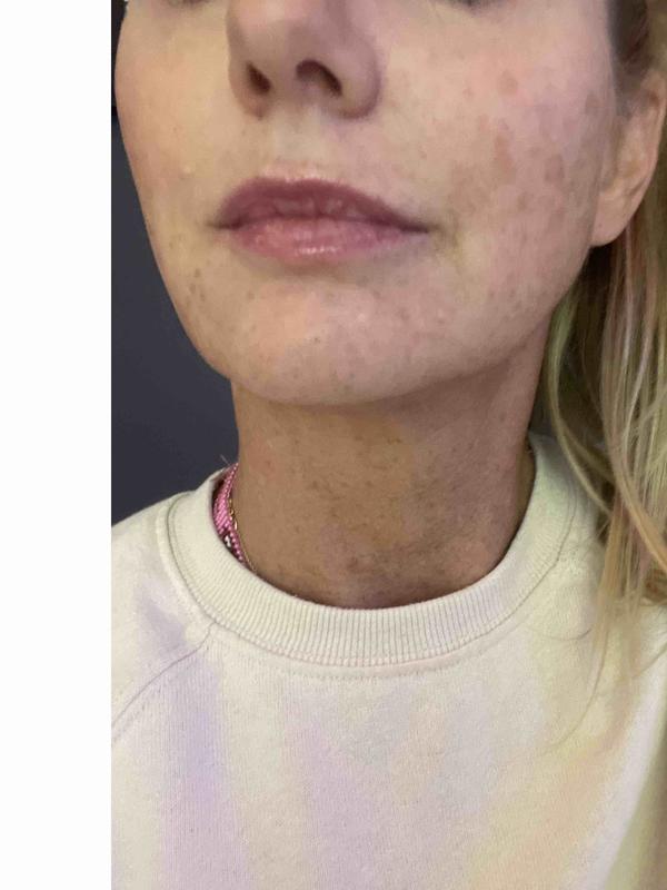 Review Thumbnail Image 0 227571822