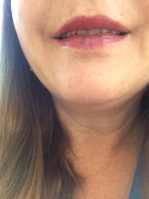 Review Thumbnail Image 0 114132673