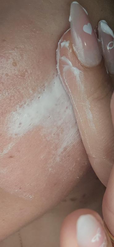 Customer photo for "Deep Moisturizer but.."
