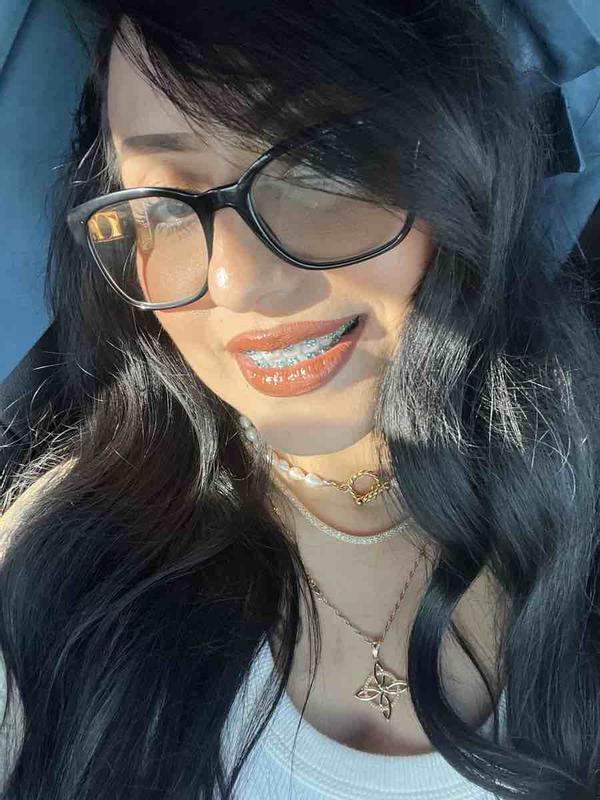 so glossy