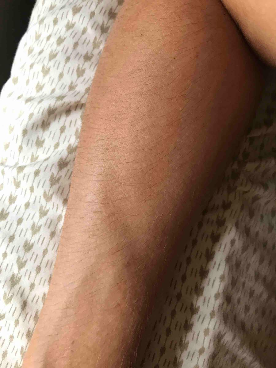 Review Thumbnail Image 1 198653306