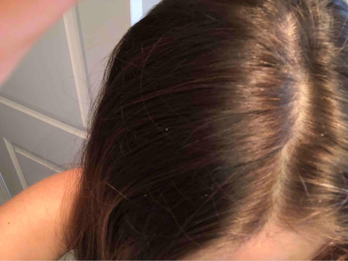 Review Thumbnail Image 0 197643495