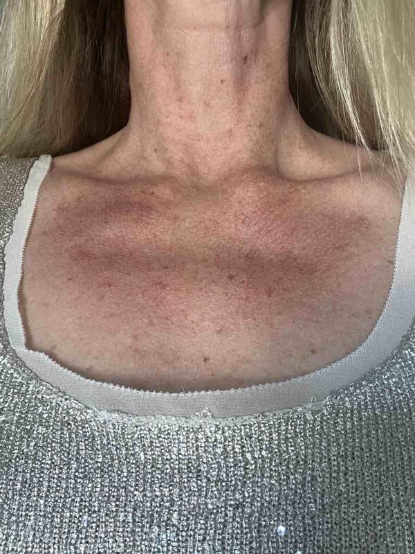 Review Thumbnail Image 1 248532826