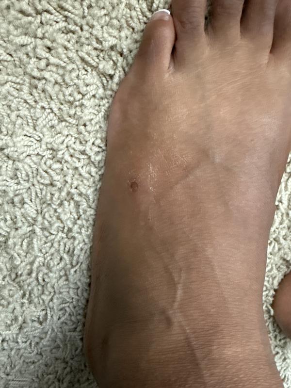 Customer photo for "The Hurt so bad!"