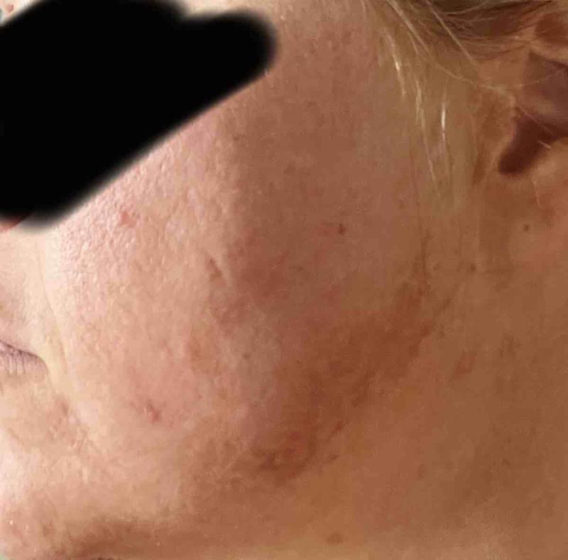 Review Thumbnail Image 1 236475640