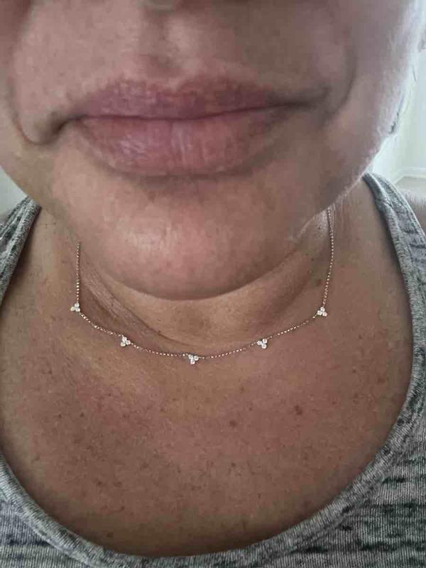 Review Thumbnail Image 0 228276884