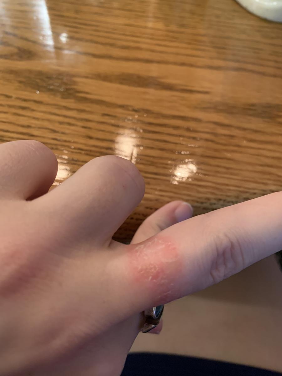 Review Thumbnail Image 1 205621046