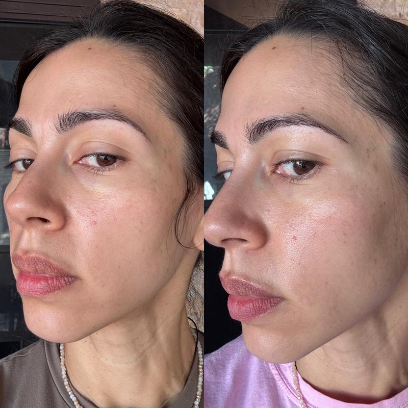 Customer photo for "A subtle but noticeable difference"