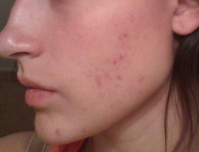 Review Thumbnail Image 1 124770511