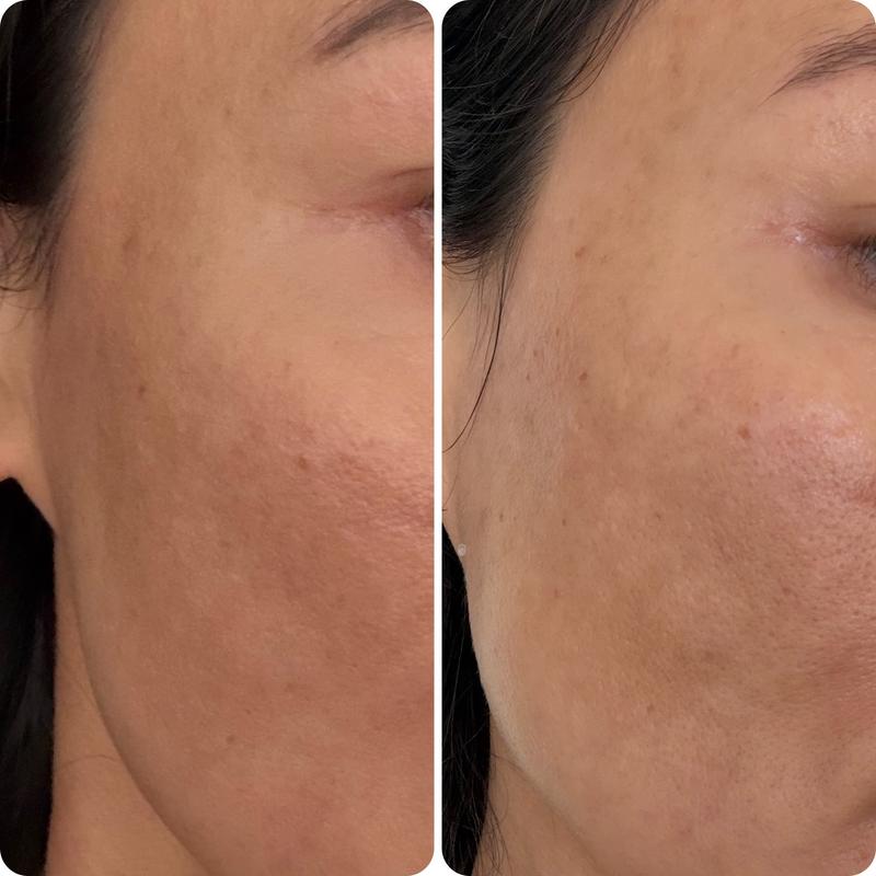 Review Thumbnail Image 0 249083831