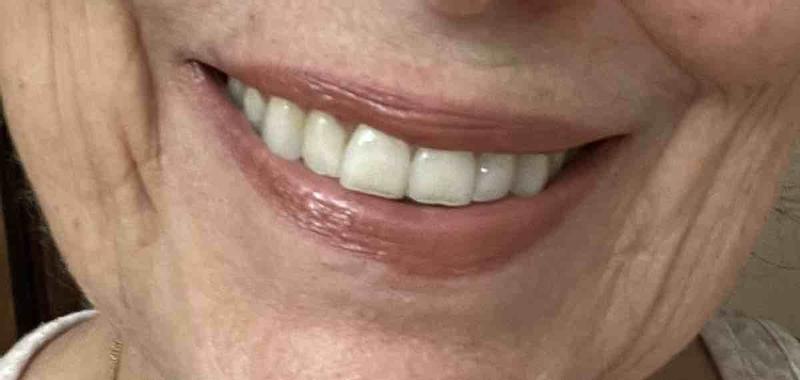 Review Thumbnail Image 0 217521343