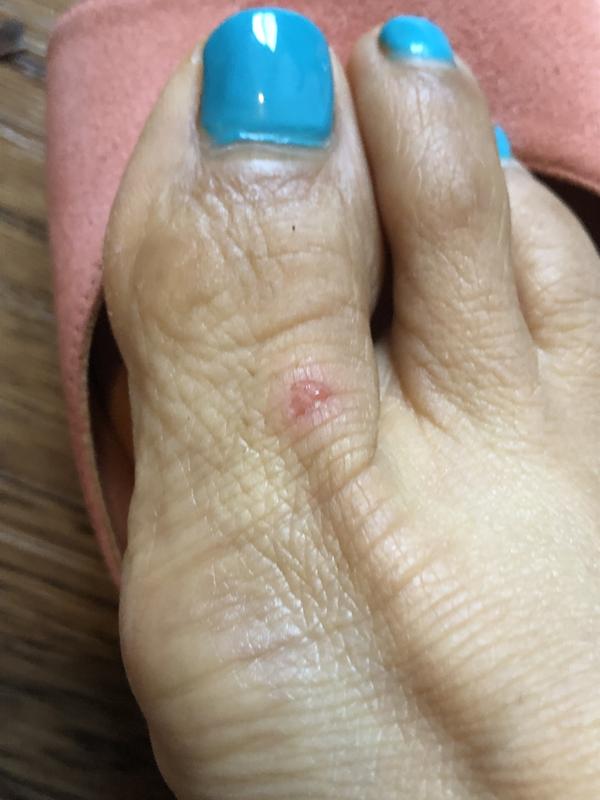 Review Thumbnail Image 1 237267242