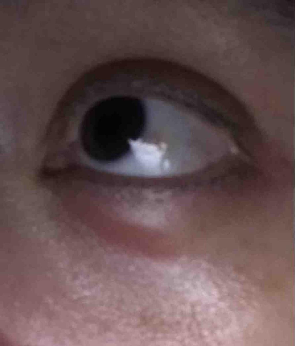 Review Thumbnail Image 0 202105379