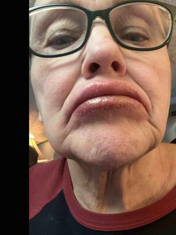 Review Thumbnail Image 0 247752608