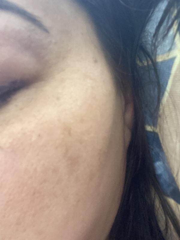 Customer photo for "I did not see changes on my face."